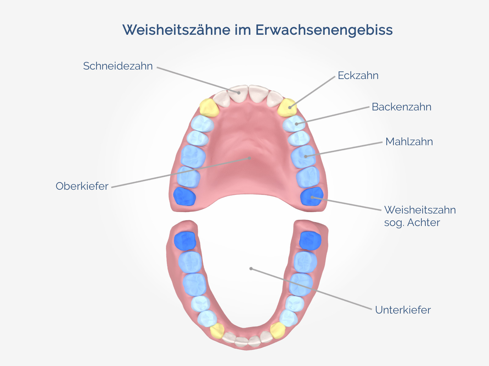 Zahnfleisch weisheitszahn drückt gegen Zahnentzündung: Pulpitis,